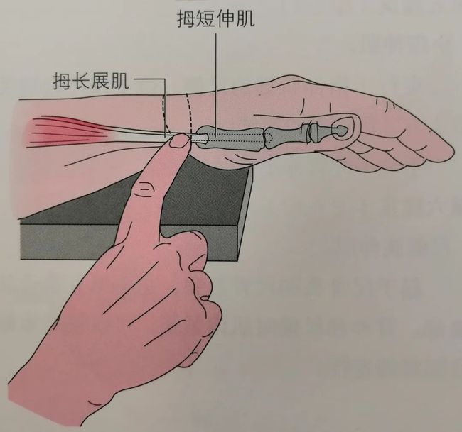 手腕痛玩手机_玩手机打游戏手腕疼怎么办_长期打手游手腕疼