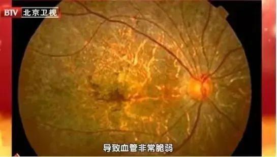 眼睛玩手机流眼泪干涩怎么办_玩手机游戏后眼睛发痒流泪_眼睛玩游戏玩到流眼泪